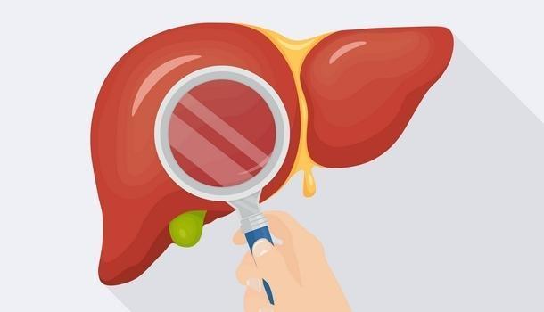 【肝硬化腹水】重组人白蛋白注射液治疗肝硬化腹水患者的临床招募