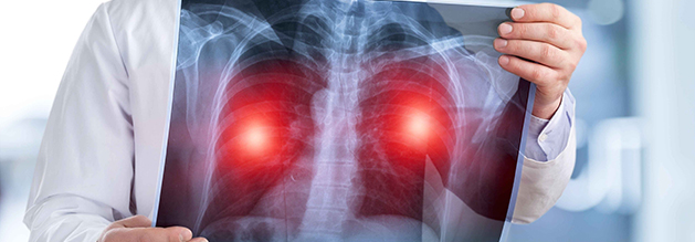 ROS1融合阳性非小细胞肺癌患者术后辅助治疗的临床试验招募