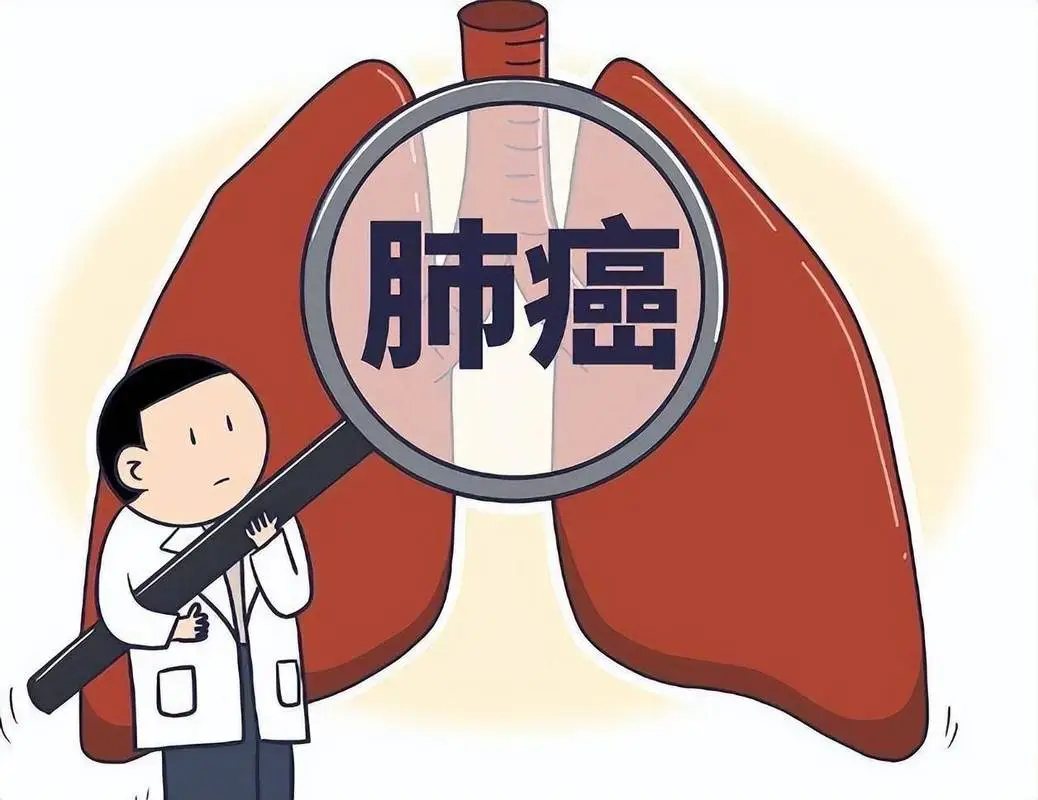 胸痛≠胃病！年轻人忽视的肺癌信号，有人拖到晚期才后悔