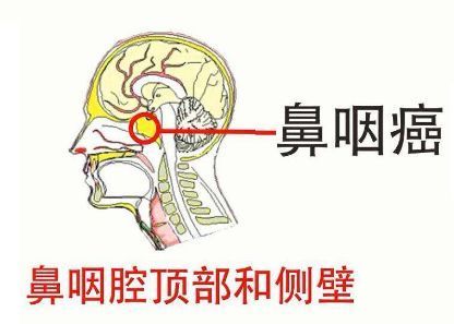 郁仁存中医肿瘤医院