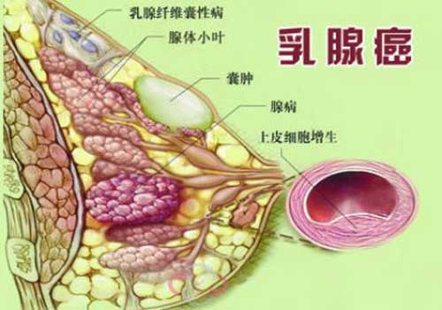 郁仁存中医肿瘤医院 郁仁存中医肿瘤医院