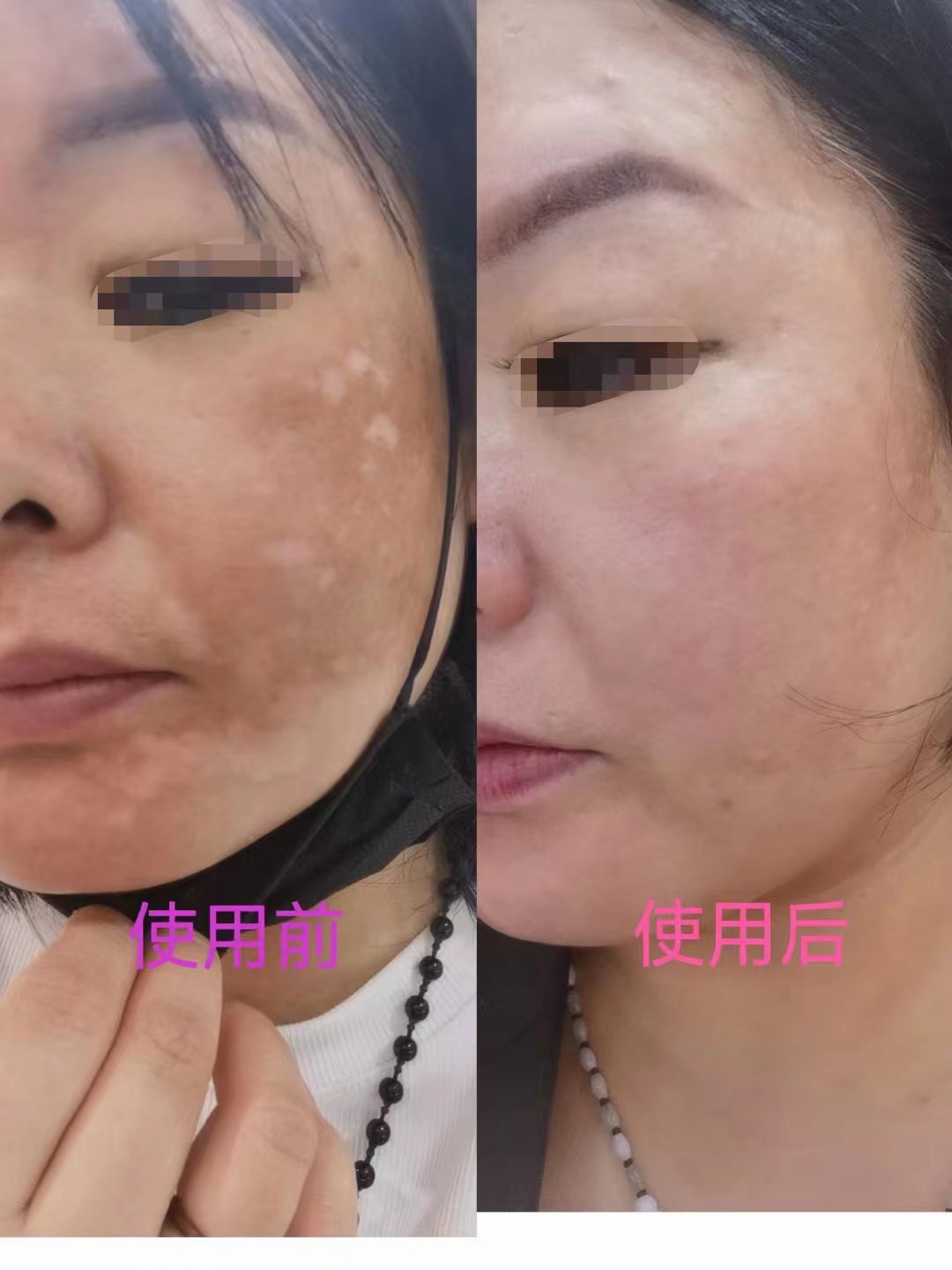 荟妍丽轻疗美肤馆优势在哪？