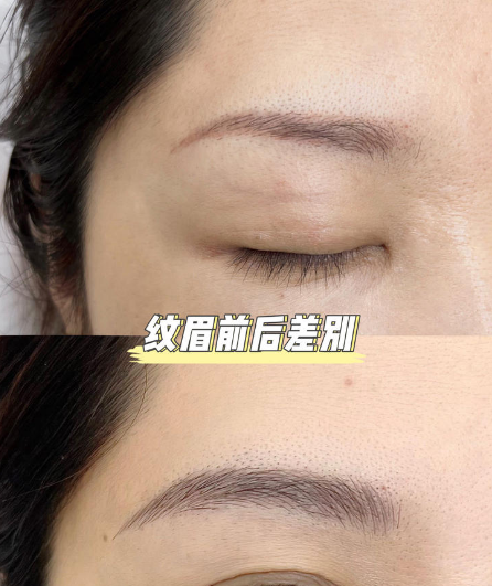 毛发再生辅助设计