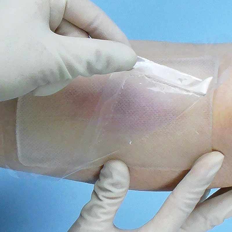 医用水凝胶创伤敷料