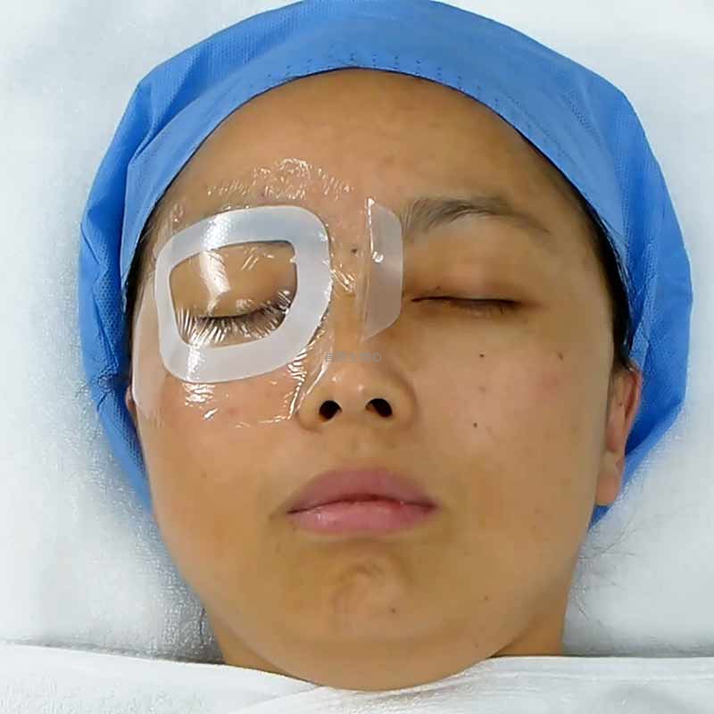 医用水凝胶眼疗贴