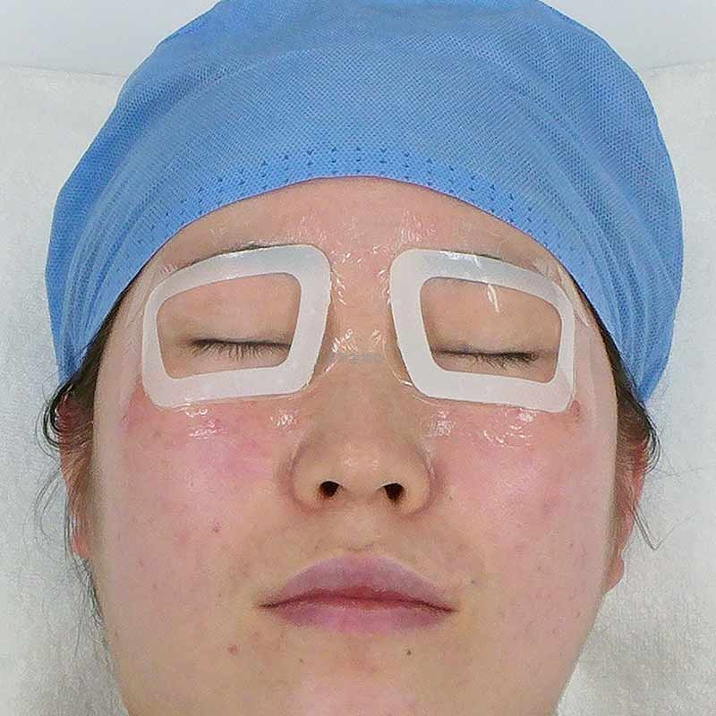 医用水凝胶眼部保护敷贴