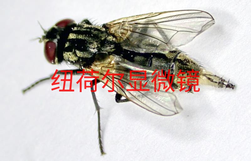 《显微镜下的血小板》
