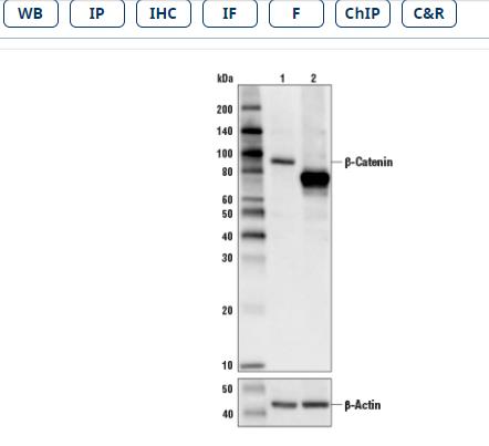 CST 一抗 β-Catenin (D10A8) XP Rabbit mAb 20ul 8480T