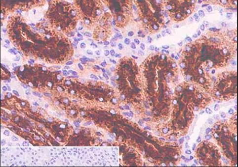 Abcam 重组Anti-CD15抗体[SP159] (ab135377)