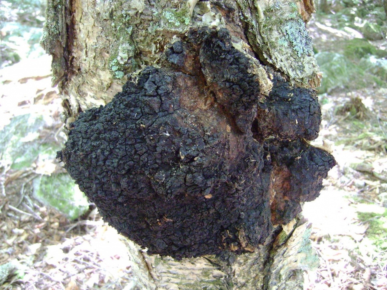 深度解析：天然真菌白桦茸对特定乳腺疾病的辅助作用研究