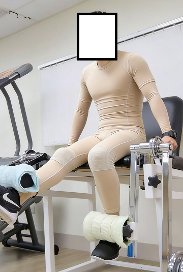 成都惠好安康烧伤康复故事：行走在烈焰之上：我的40%烧伤与三年复健路