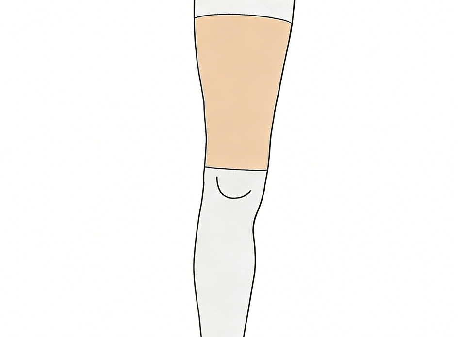 惠好安康腿烧伤压力短腿套定制