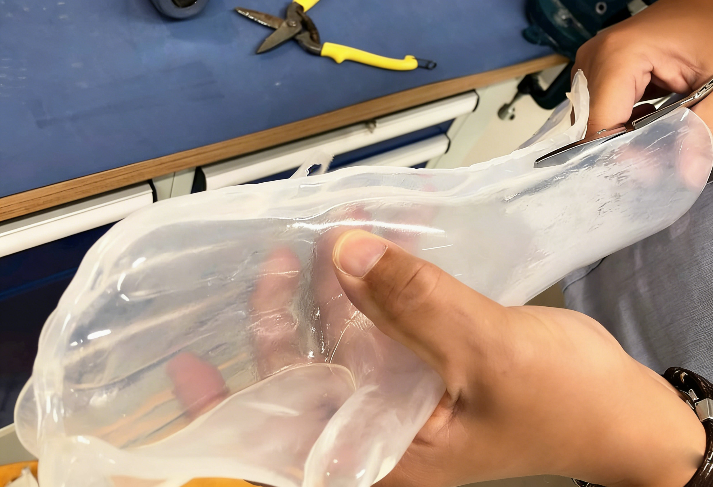 惠好安康硅酮全手支具定制