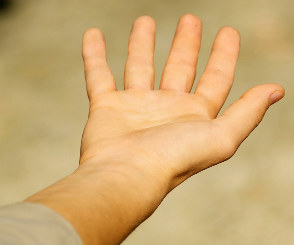 成都惠好安康烧伤康复故事：山城匠人的双手涅槃——重庆王工三度烧伤后的重生之路