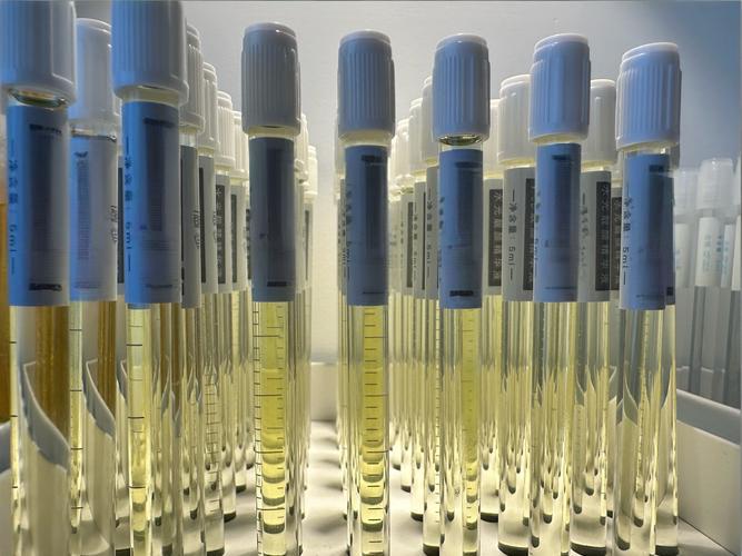 紫外可见分光光度计：如何准确测定菌液浓度？