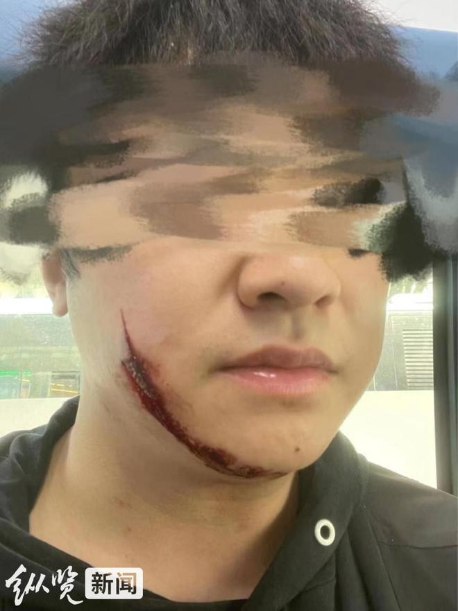 重庆一农业执法人员与人发生口角后当街持菜刀伤人,伤者家人:施暴者仍在正常上班