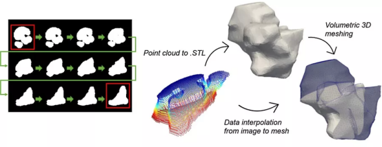 研究人员获取T2w-MRI切片并将其转换为.STL文件，以实现3D体积网格划分