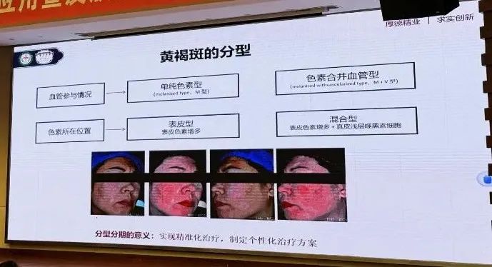 ece9f844d045413c2bcf035d32ee08a_副本.jpg