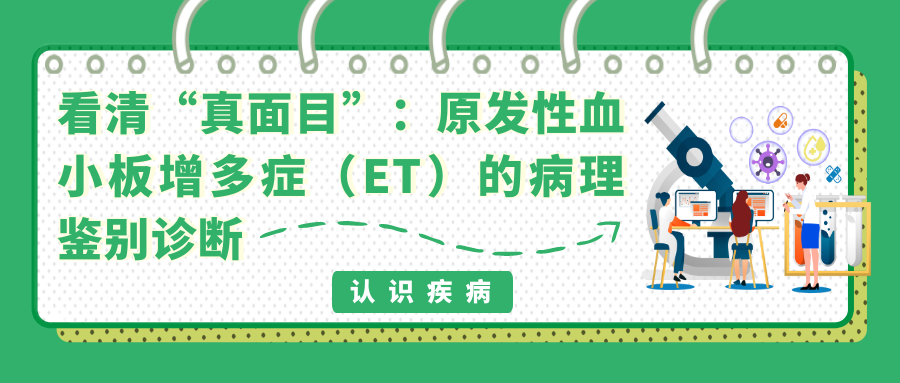 认识疾病 | 看清“真面目”：原发性血小板增多症（ET）的病理鉴别诊断