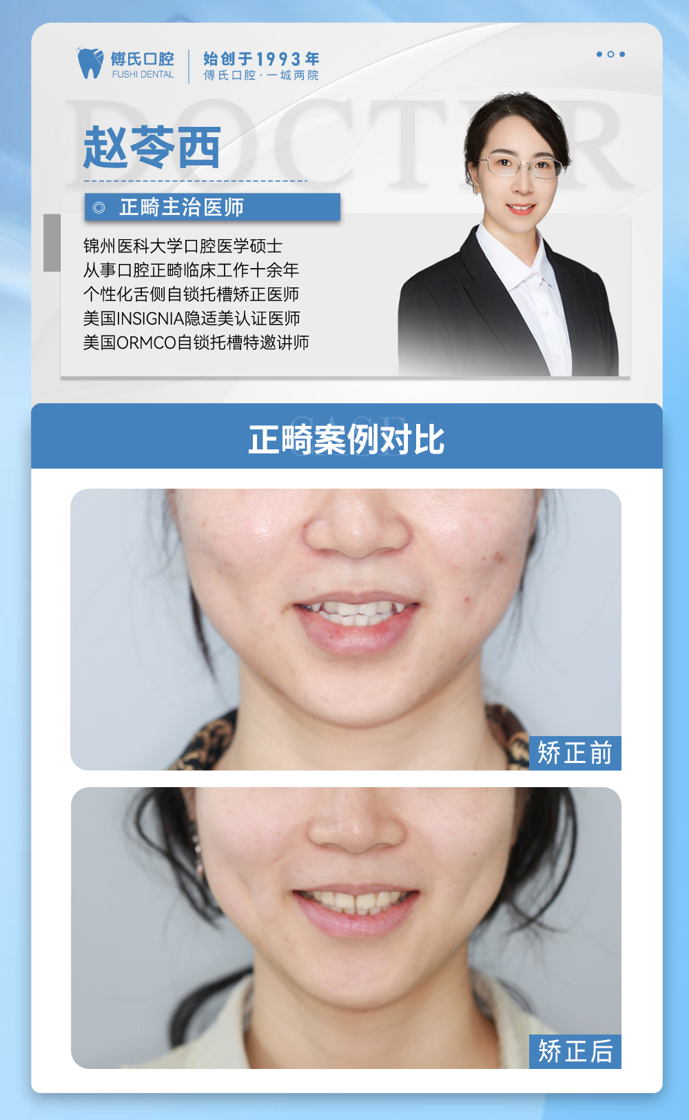 傅氏口腔牙齿拥挤侧貌微凸矫正案例分享! 傅氏口腔牙齿拥挤侧貌微凸矫正案例分享!