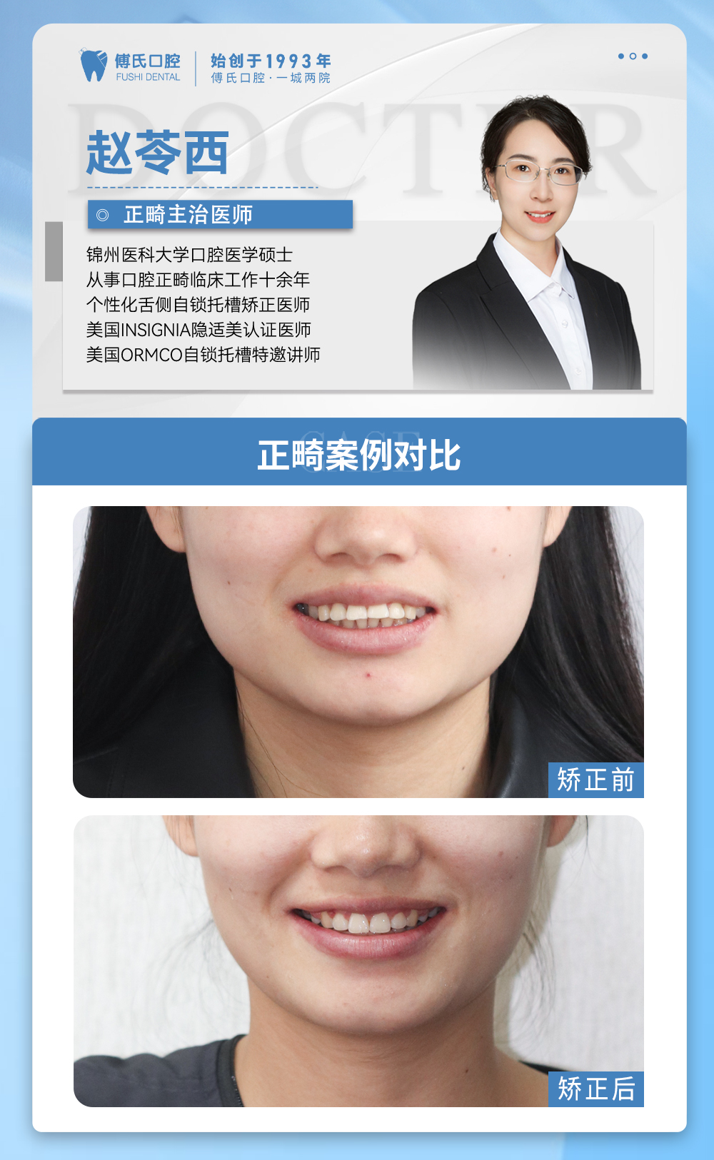 义乌傅氏口腔牙齿前突、嘴凸矫正案例分享! 义乌傅氏口腔牙齿前突、嘴凸矫正案例分享!