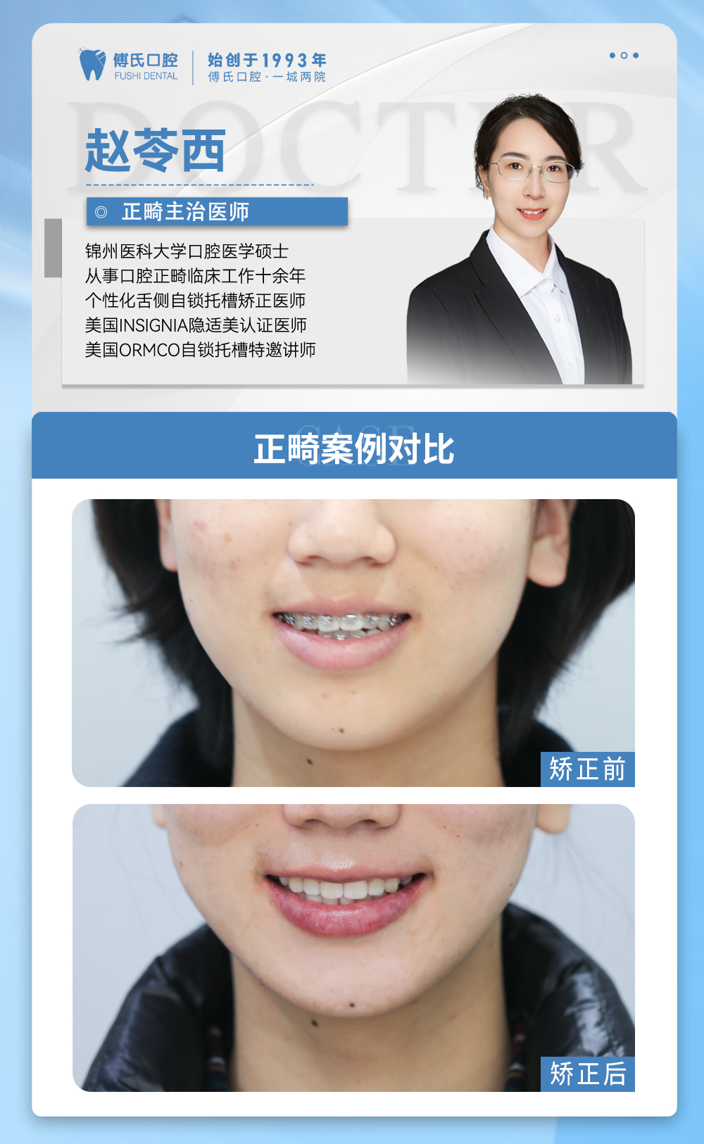 义乌傅氏口腔下颌后缩矫正案例分享！