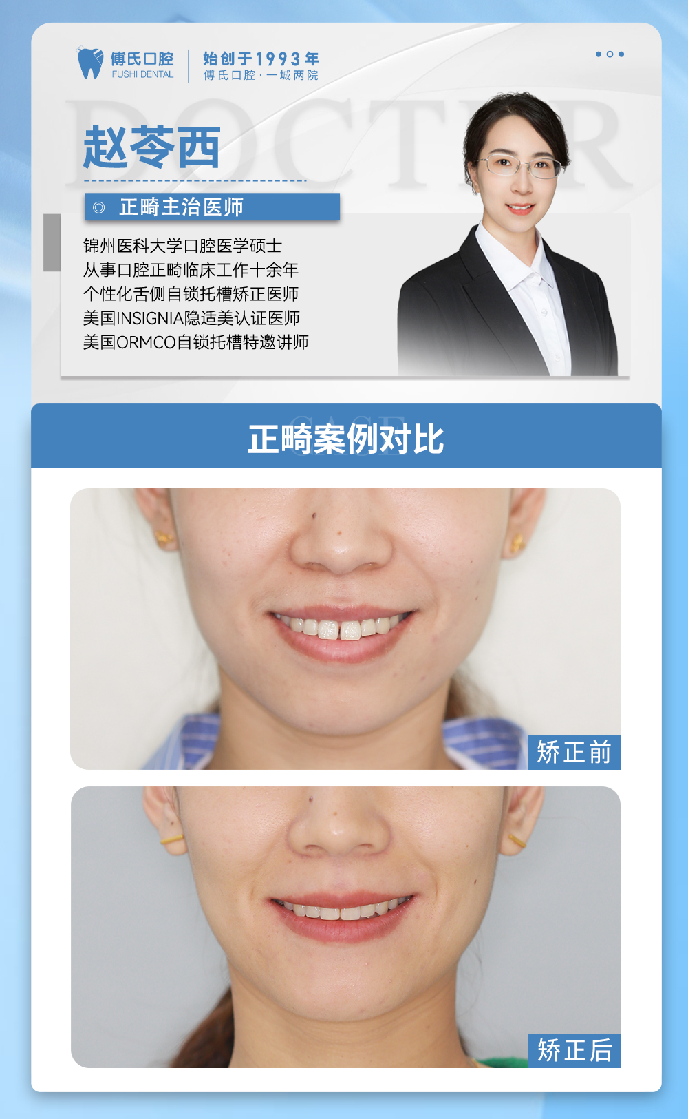 义乌傅氏口腔嘴凸下巴后缩矫正案例分享！