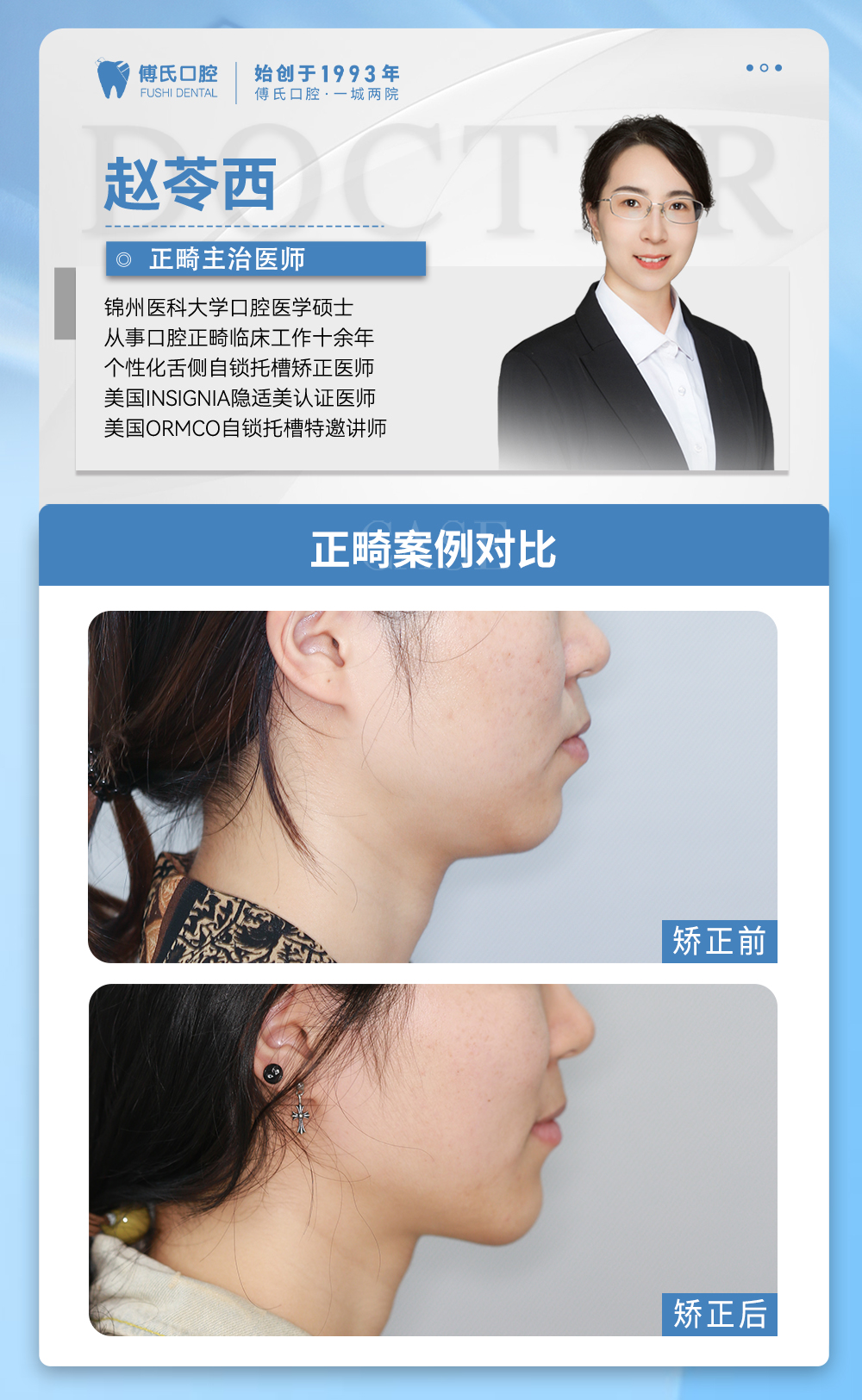 傅氏口腔牙齿拥挤侧貌微凸矫正案例分享! 傅氏口腔牙齿拥挤侧貌微凸矫正案例分享!