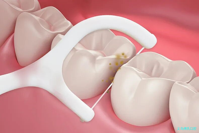 元宵佳节,汤圆虽甜,不及您的一口好牙更“圆”满! 元宵佳节,汤圆虽甜,不及您的一口好牙更“圆”满!