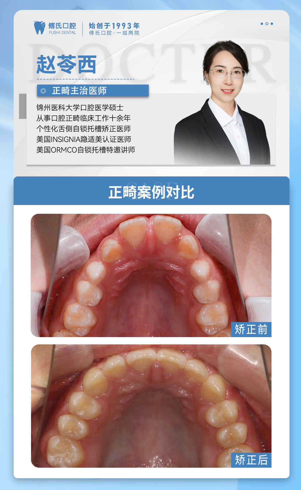义乌傅氏口腔嘴凸下巴后缩牙齿散隙矫正案例分享！
