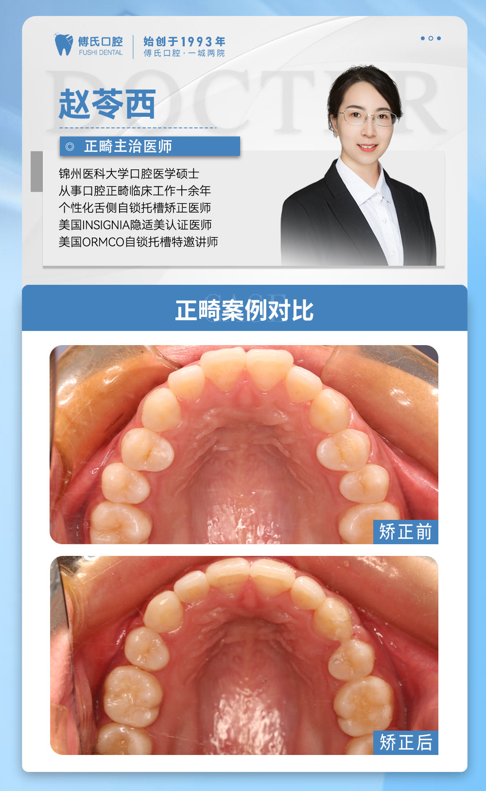 义乌傅氏口腔下颌后缩矫正案例分享！