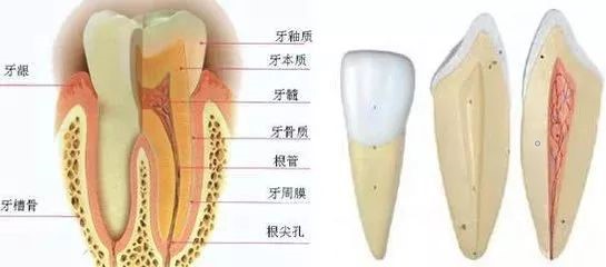 拆了牙套，牙齿上为何会有白斑？