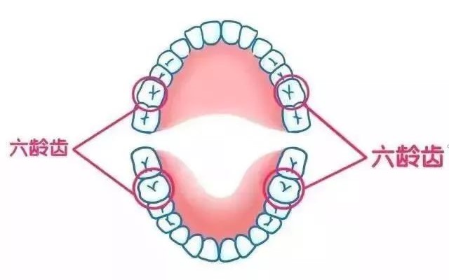 孩子窝沟封闭，爸妈们基本不当回事！—义乌傅氏口腔