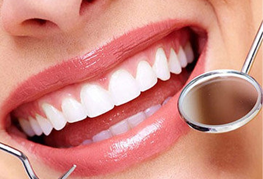 牙齿矫治结束后,究竟要戴多久保持器?—义乌傅氏口腔 牙齿矫治结束后,究竟要戴多久保持器?—义乌傅氏口腔