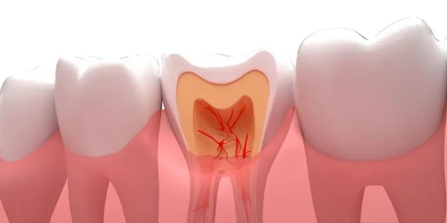 牙疼含口冰水就能好吗？—义乌傅氏口腔