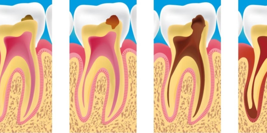牙疼含口冰水就能好吗？—义乌傅氏口腔