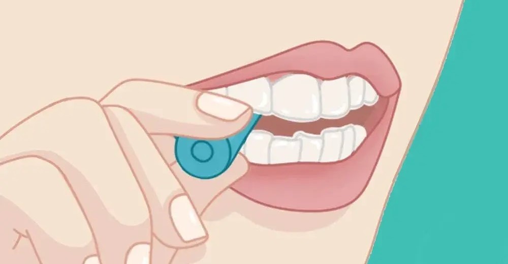 矫正完，牙齿必须要戴保持器吗？—义乌牙齿矫正