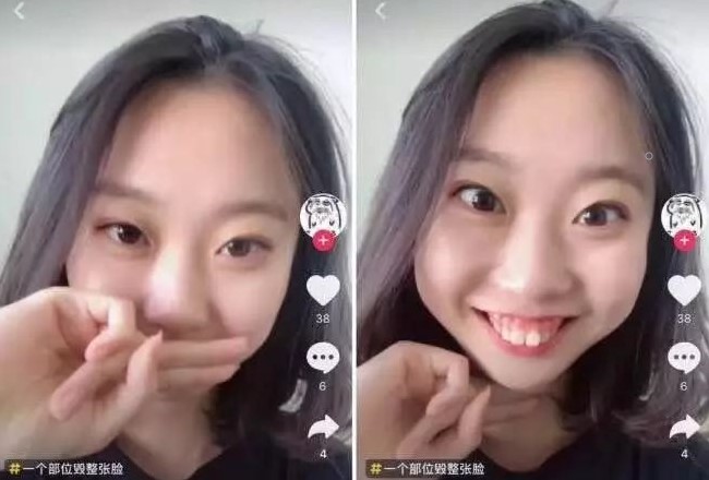 整牙等于变美，什么时候都不迟！