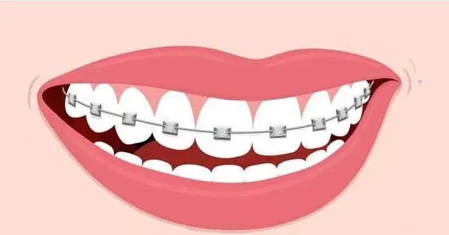 龅牙是遗传的吗？—义乌口腔医院