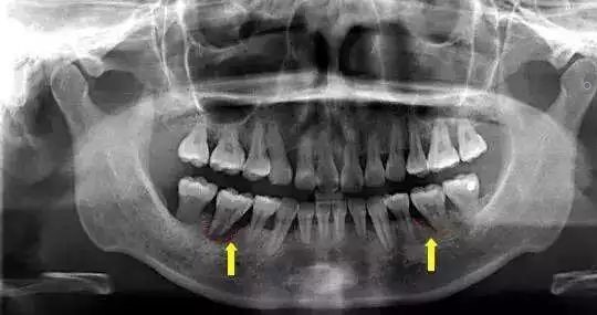 哺乳期,可以去看牙吗? 哺乳期,可以去看牙吗?