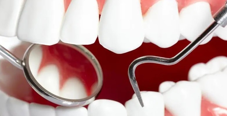 牙齿矫正是不是超级疼? 牙齿矫正是不是超级疼?