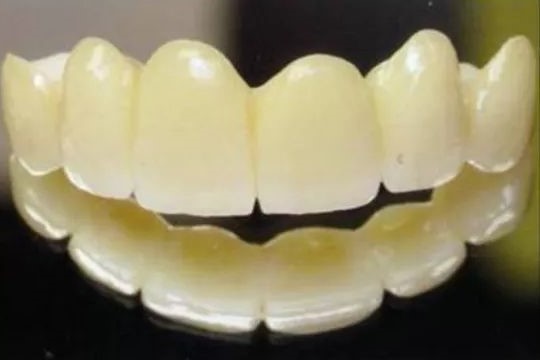 全瓷牙，从此让你摆脱牙龈黑线！—义乌傅氏口腔