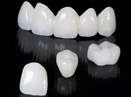 全瓷牙，从此让你摆脱牙龈黑线！—义乌傅氏口腔