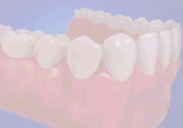 成年了，牙齿矫正会不会没效果？—义乌傅氏口腔