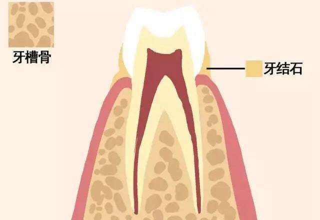 动图告诉你牙齿的脱落过程！