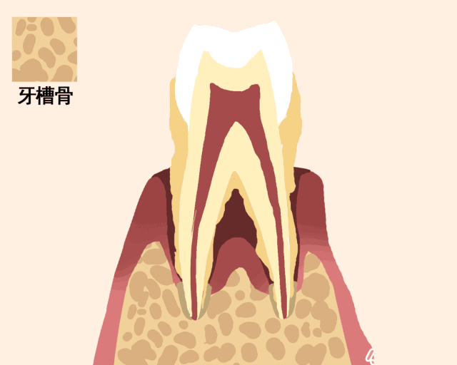 动图告诉你牙齿的脱落过程！