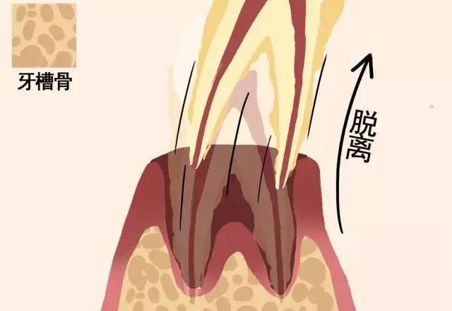动图告诉你牙齿的脱落过程！