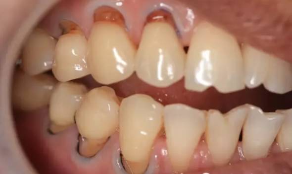 快停下！牙齿快被刷断了！—义乌傅氏口腔