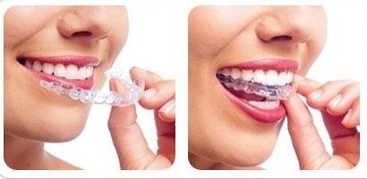 正畸医师和正畸患者的经典对话，太暖心了！—义乌傅氏口腔