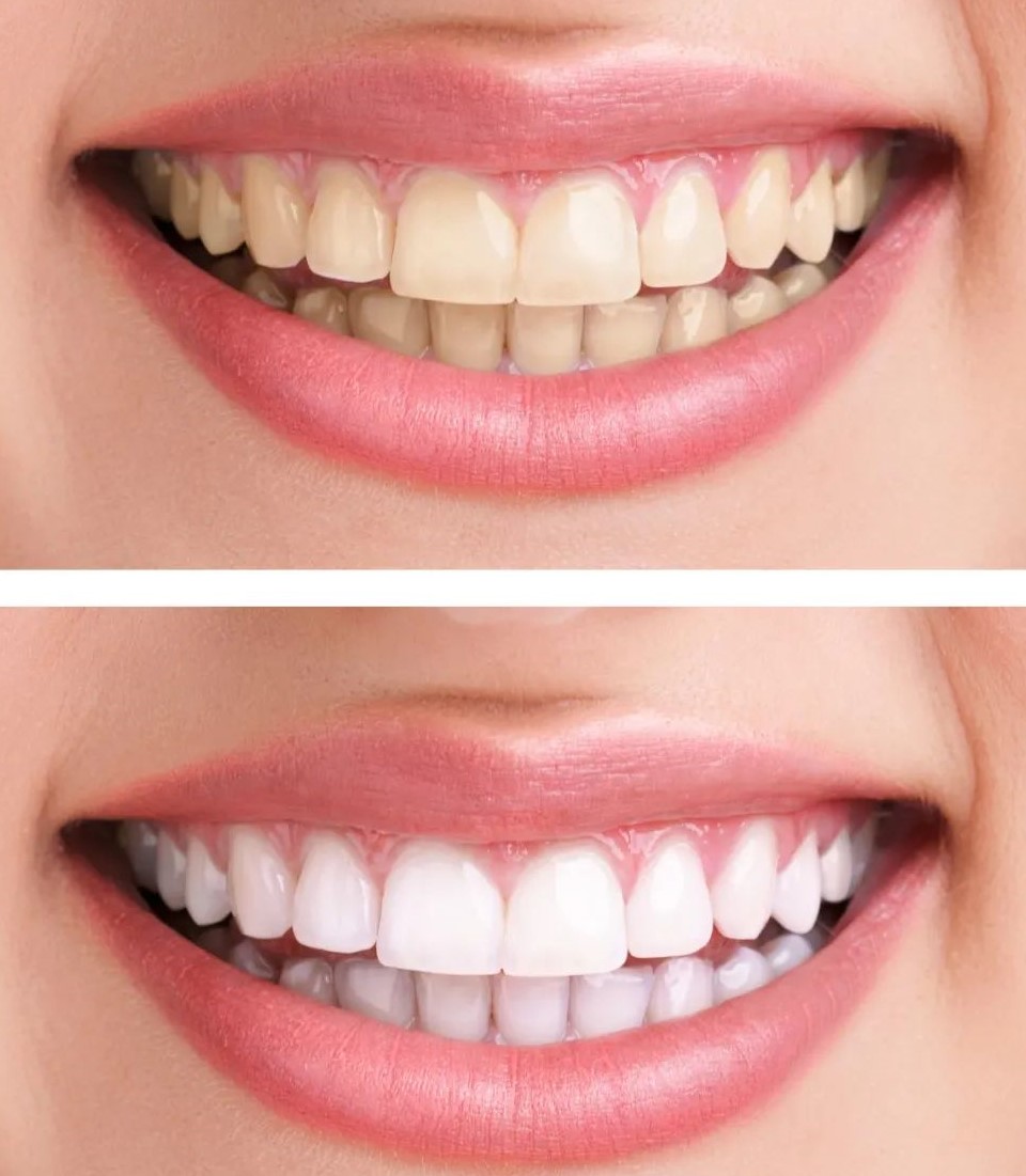 正畸医师和正畸患者的经典对话，太暖心了！—义乌傅氏口腔